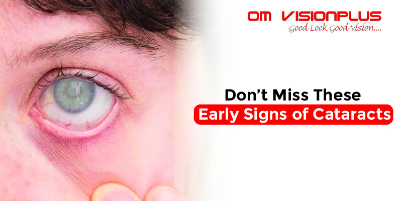 Don’t Miss These Early Signs of Cataracts